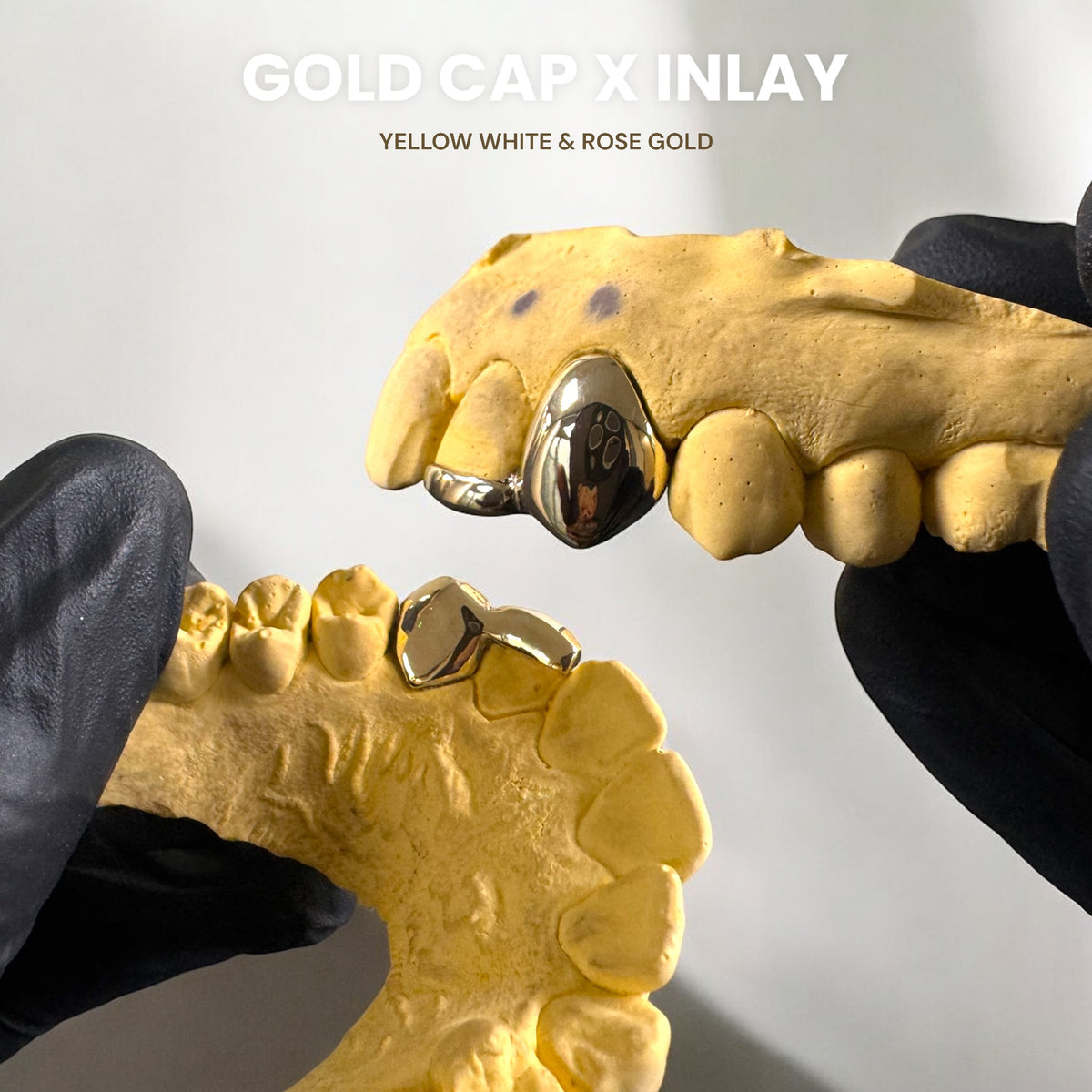 Gold Cap X Inlay (Tip) MKGRILLZ LTD