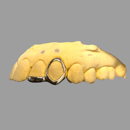Window Grillz X Plain Inlay (Tip)